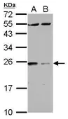Anti-14-3-3 zeta antibody used in Western Blot (WB). GTX114140