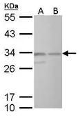 Anti-CREM antibody used in Western Blot (WB). GTX114146