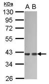 Anti-G protein alpha 12 antibody [N3C3] used in Western Blot (WB). GTX114147