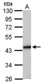 Anti-HLA-B antibody used in Western Blot (WB). GTX114151