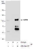 Anti-NUP98 antibody [N3C1], Internal used in Immunoprecipitation (IP). GTX114157