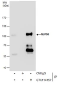 Anti-NUP98 antibody [N3C1], Internal used in Immunoprecipitation (IP). GTX114157