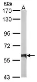 Anti-Rhotekin antibody used in Western Blot (WB). GTX114161