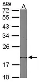 Anti-Destrin antibody used in Western Blot (WB). GTX114170