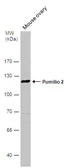 Anti-Pumilio 2 antibody [C2C3], C-term used in Western Blot (WB). GTX114172