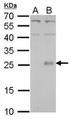 Anti-NNT1 antibody used in Western Blot (WB). GTX114173