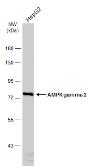 Anti-AMPK gamma 2 antibody [C2C3], C-term used in Western Blot (WB). GTX114178