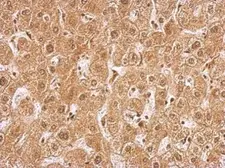 Anti-AMPK gamma 2 antibody [C2C3], C-term used in IHC (Paraffin sections) (IHC-P). GTX114178
