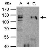 Anti-HDAC7 antibody [C2C3], C-term used in Immunoprecipitation (IP). GTX114179