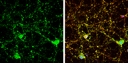 Anti-Calcineurin B antibody used in Immunocytochemistry/ Immunofluorescence (ICC/IF). GTX114181