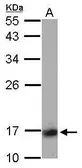 Anti-Calcineurin B antibody used in Western Blot (WB). GTX114181