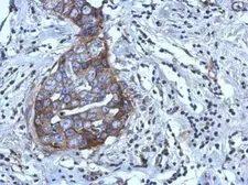 Anti-RGS4 antibody used in IHC (Paraffin sections) (IHC-P). GTX114184