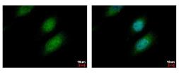 Anti-UBE2A antibody used in Immunocytochemistry/ Immunofluorescence (ICC/IF). GTX114186