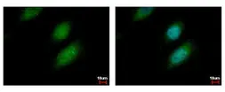 Anti-UBE2A antibody used in Immunocytochemistry/ Immunofluorescence (ICC/IF). GTX114186