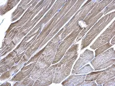 Anti-VDAC1 antibody [N1C2] used in IHC (Paraffin sections) (IHC-P). GTX114187