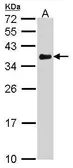 Anti-VDAC1 antibody [N1C2] used in Western Blot (WB). GTX114187