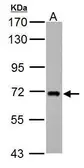 Anti-ZDHHC17 antibody used in Western Blot (WB). GTX114192