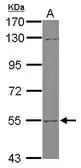 Anti-UGT2B7 antibody used in Western Blot (WB). GTX114203