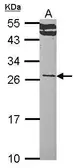 Anti-RALA antibody used in Western Blot (WB). GTX114204