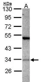 Anti-PACT antibody [N2C3] used in Western Blot (WB). GTX114215