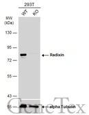 Anti-Radixin antibody [N3C3] used in Western Blot (WB). GTX114219