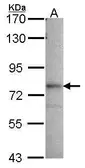 Anti-GMP synthase antibody [N1N3] used in Western Blot (WB). GTX114225
