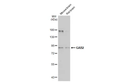 Anti-GAB2 antibody [N1C1] used in Western Blot (WB). GTX114226