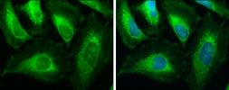 Anti-ACAA1 antibody used in Immunocytochemistry/ Immunofluorescence (ICC/IF). GTX114229