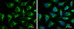 Anti-ACAA1 antibody used in Immunocytochemistry/ Immunofluorescence (ICC/IF). GTX114230