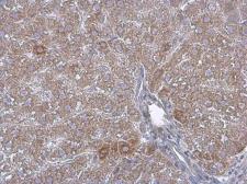 Anti-ACAA1 antibody used in IHC (Paraffin sections) (IHC-P). GTX114230