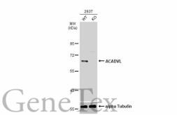 Anti-ACADVL antibody [N1C1] used in Western Blot (WB). GTX114232