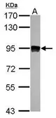Anti-Aconitase 2 antibody [N1N3] used in Western Blot (WB). GTX114233