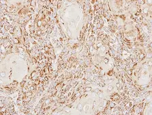 Anti-ACP2 antibody [N2C3] used in IHC (Paraffin sections) (IHC-P). GTX114234