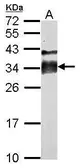 Anti-Acrosomal vesicle protein antibody used in Western Blot (WB). GTX114236