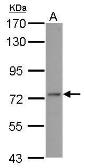 Anti-ADAR2 antibody used in Western Blot (WB). GTX114237