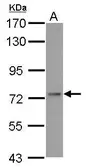 Anti-ADAR2 antibody used in Western Blot (WB). GTX114237