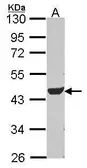 Anti-ADSL antibody [N3C3] used in Western Blot (WB). GTX114243
