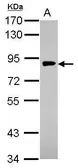 Anti-gamma Adaptin antibody [N1N3] used in Western Blot (WB). GTX114244