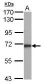 Anti-ALAS-H antibody [N1N3] used in Western Blot (WB). GTX114245