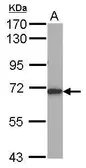 Anti-ALAS-H antibody [N1N3] used in Western Blot (WB). GTX114245