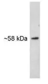 Anti-SNTB2 antibody [1351] used in Western Blot (WB). GTX11425