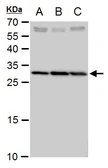 Anti-SLC25A6 antibody used in Western Blot (WB). GTX114252