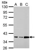 Anti-Annexin III antibody used in Western Blot (WB). GTX114253