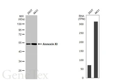 Anti-Annexin XI antibody used in Western Blot (WB). GTX114255