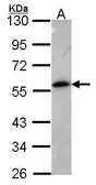 Anti-Annexin XI antibody used in Western Blot (WB). GTX114255