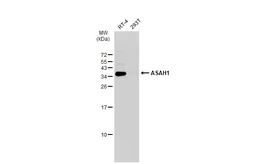 Anti-ASAH1 antibody used in Western Blot (WB). GTX114267