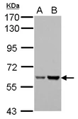 Anti-Asparagine synthetase antibody used in Western Blot (WB). GTX114269