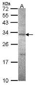 Anti-Sodium/Potassium ATPase beta 3 antibody [N2C3] used in Western Blot (WB). GTX114272