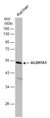 Anti-ALDH7A1 antibody [C1C3] used in Western Blot (WB). GTX114274