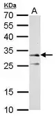 Anti-ATP synthase gamma antibody used in Western Blot (WB). GTX114275